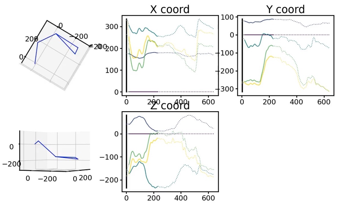 motion capture curves of a stroke patient